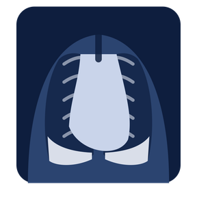Cartoon chest X-ray